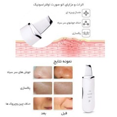 پکيج اتوي صورت دستگاه ميکرودرم خانگي