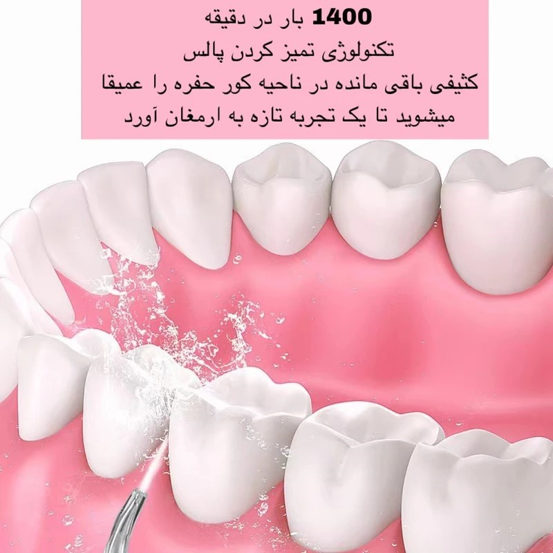 دستگاه واترجت دندان یا مسواک آبی (Oral Irrigator)
